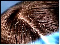 0_STATIC4a1f0_16bcb9a9_teaser.jpg